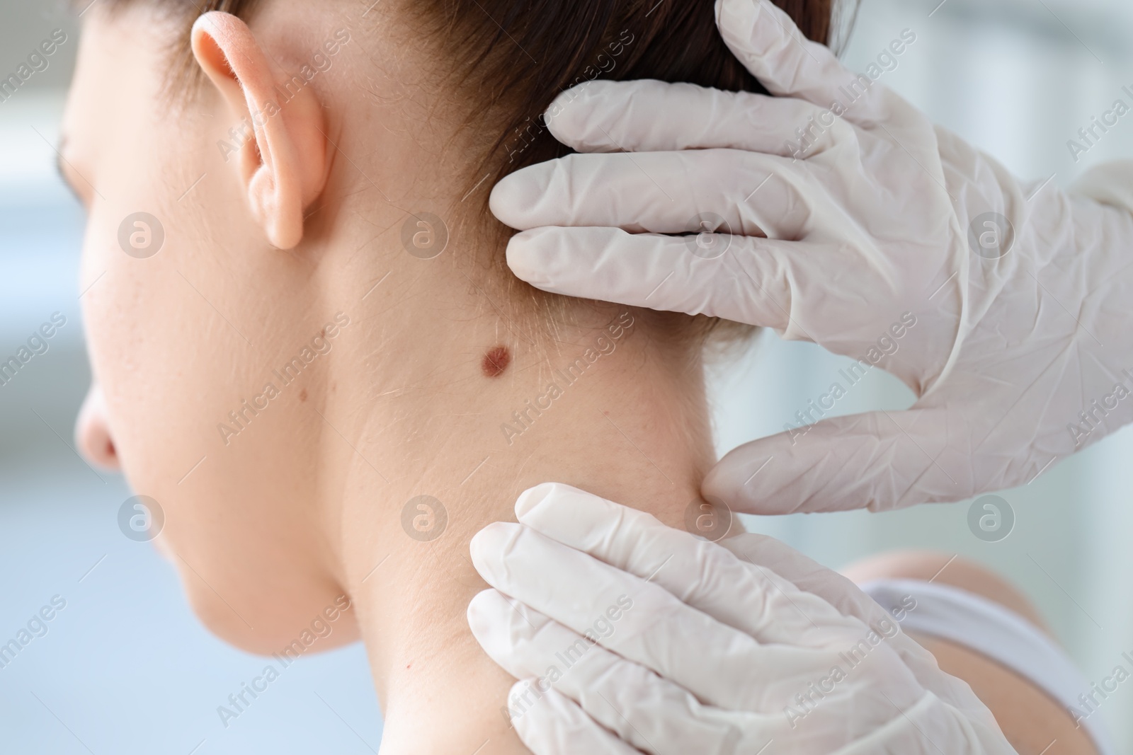 Photo of Doctor examining woman's mole in clinic, closeup