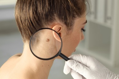 Photo of Doctor examining woman's mole with magnifying glass in clinic, closeup