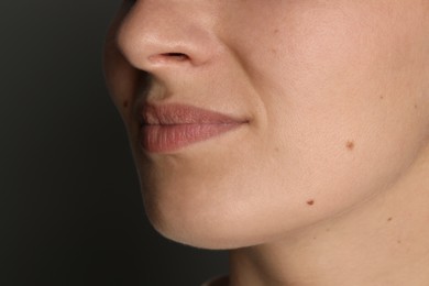 Photo of Woman with mole on her skin against grey background, closeup