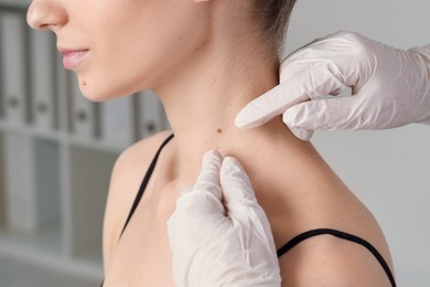 Photo of Doctor examining woman's mole in clinic, closeup
