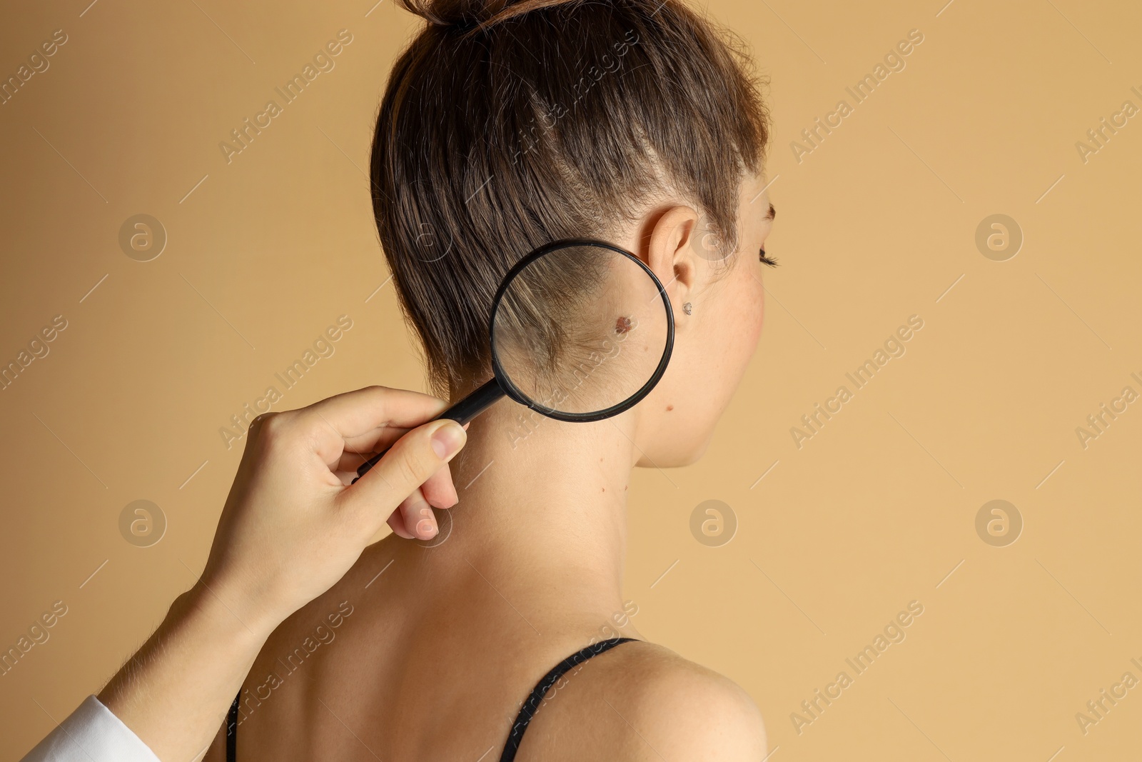 Photo of Doctor examining woman's mole with magnifying glass on beige background, closeup