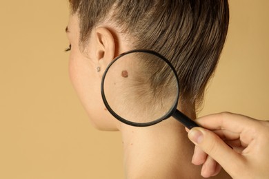 Photo of Doctor examining woman's mole with magnifying glass on beige background, closeup