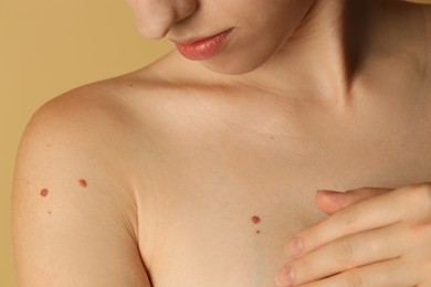 Photo of Woman with moles on her skin against beige background, closeup