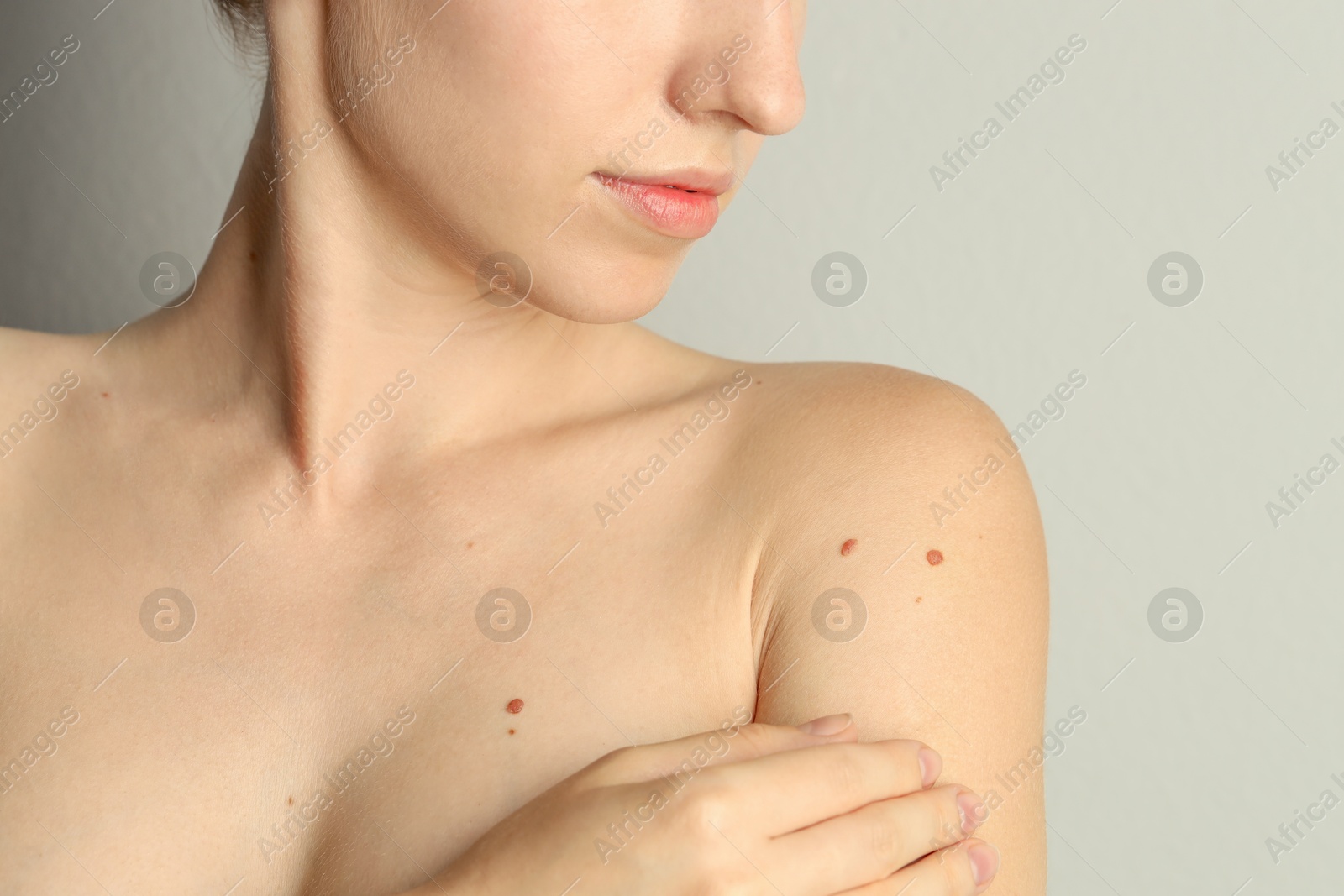 Photo of Woman with moles on her skin against light grey background, closeup