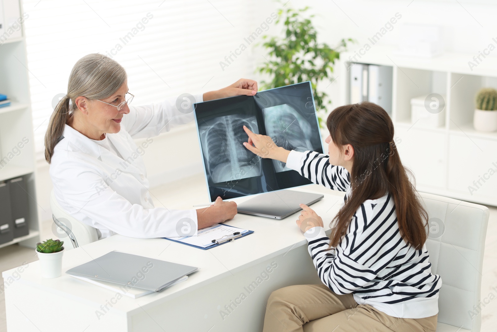 Photo of Lung disease. Doctor showing chest x-ray to her patient at table in clinic