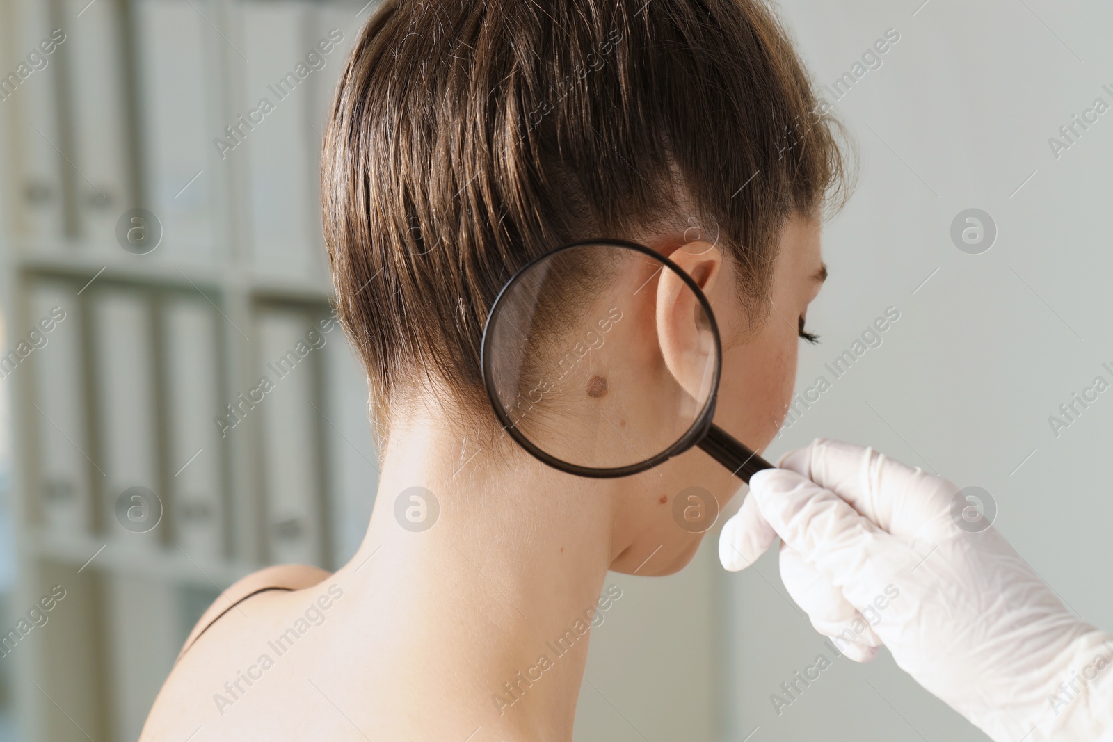 Photo of Doctor examining woman's mole with magnifying glass in clinic, closeup