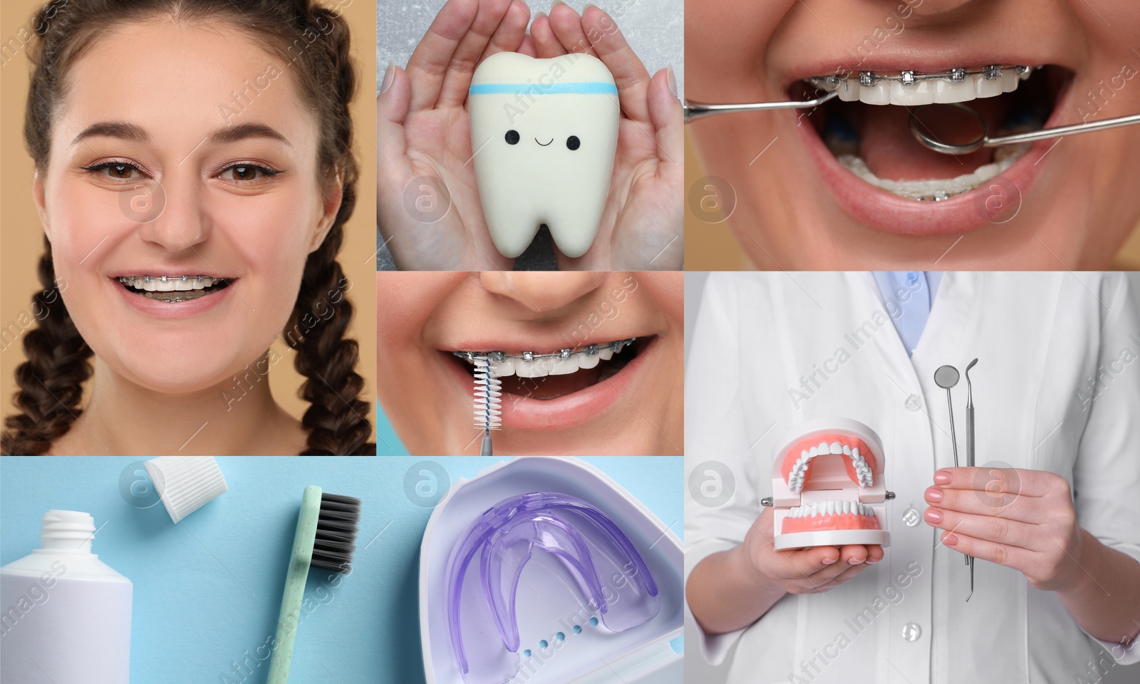 Image of Wearing braces. Collage with photos of young woman, dentist and dental tools