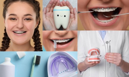 Image of Wearing braces. Collage with photos of young woman, dentist and dental tools