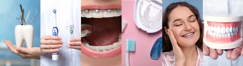 Image of Wearing braces. Collage with photos of young woman and dentistry tools