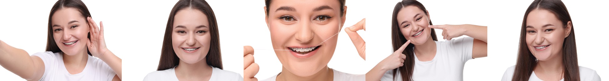 Image of Girl wearing braces on white background, collage of photos
