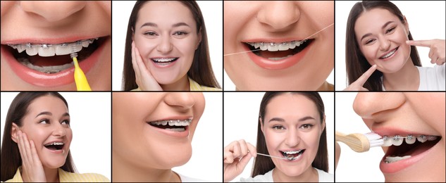 Image of Girl wearing braces on white background, collage of photos