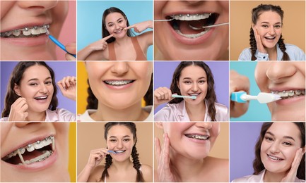 Image of Girl wearing braces on different colors backgrounds, collage of photos