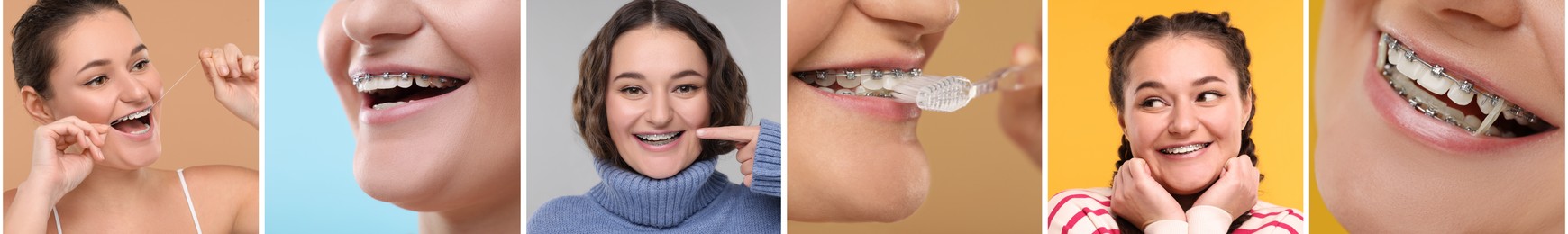 Image of Girl wearing braces on different colors backgrounds, collage of photos