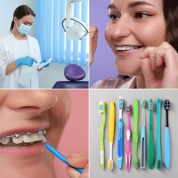 Image of Wearing braces. Collage with photos of young woman, dentist and toothbrushes