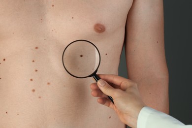 Dermatologist examining patient's birthmark with magnifying glass on grey background, closeup