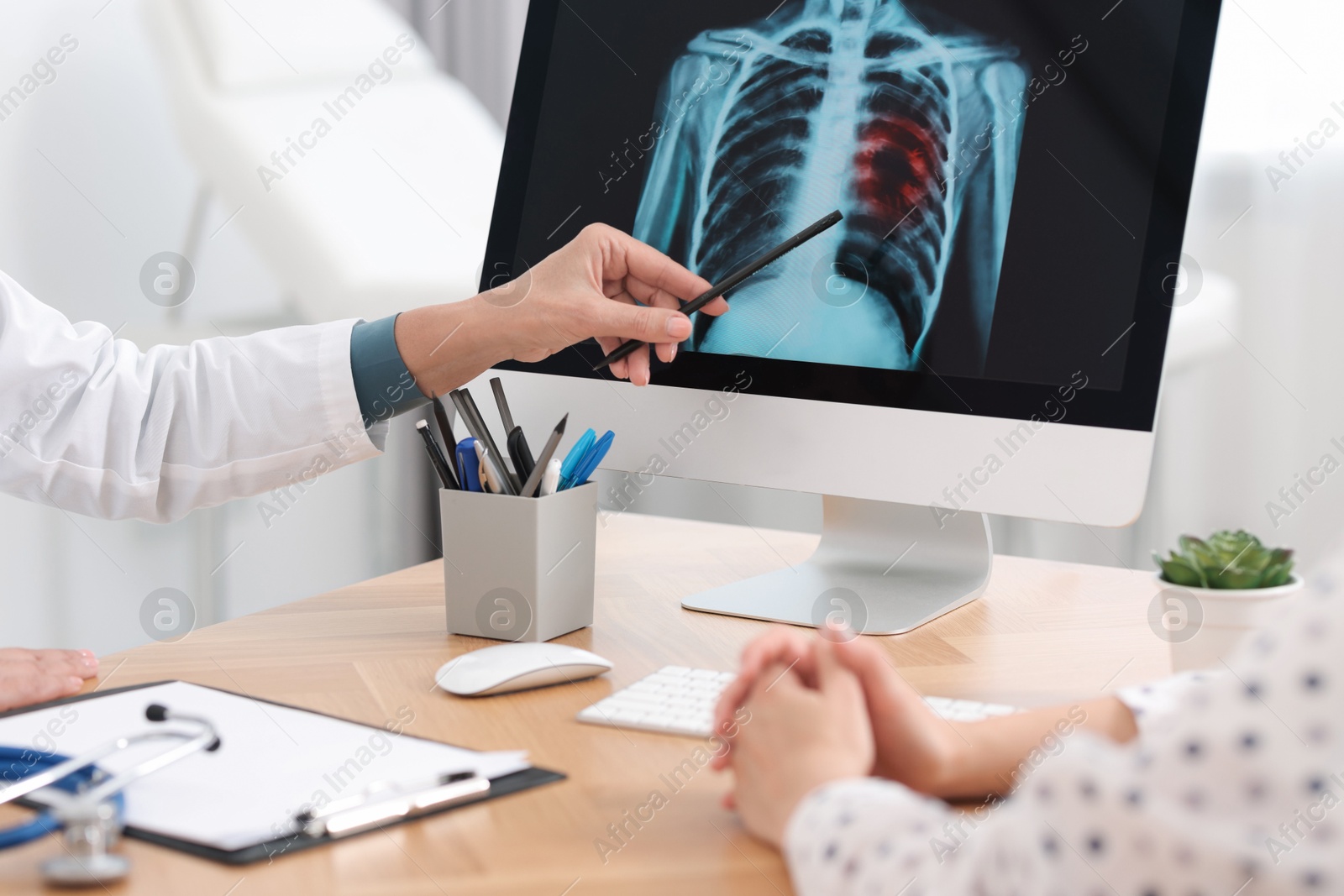 Photo of Lung cancer. Doctor showing chest x-ray to her patient in clinic, closeup