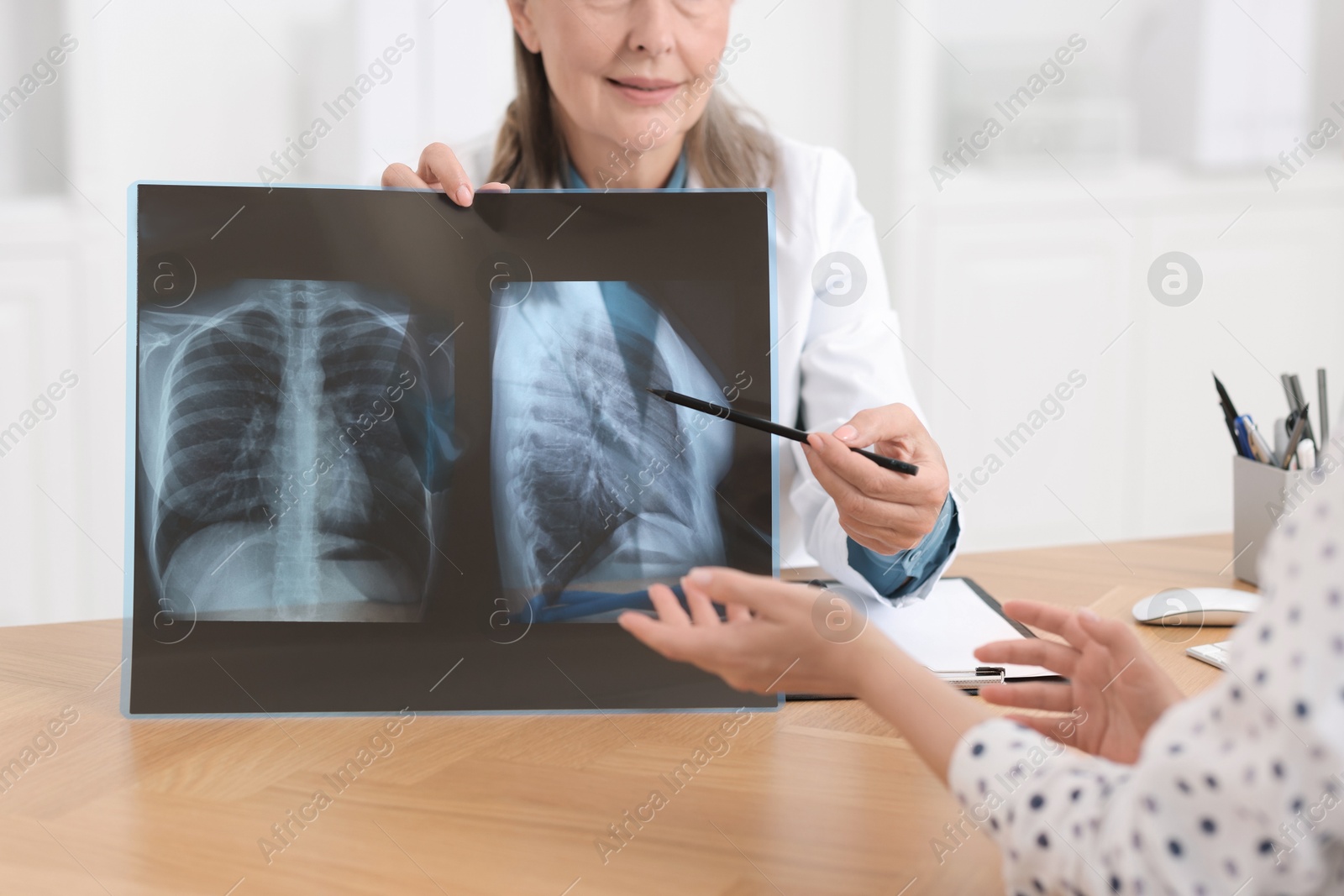 Photo of Lung disease. Doctor showing chest x-ray to her patient in clinic, closeup