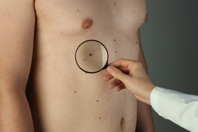 Dermatologist examining patient's birthmark with magnifying glass on grey background, closeup