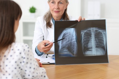 Photo of Lung disease. Doctor showing chest x-ray to her patient in clinic