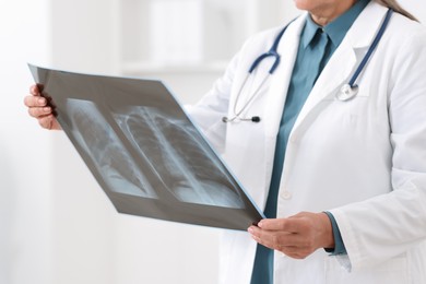Photo of Lung disease. Doctor examining chest x-ray in clinic, closeup