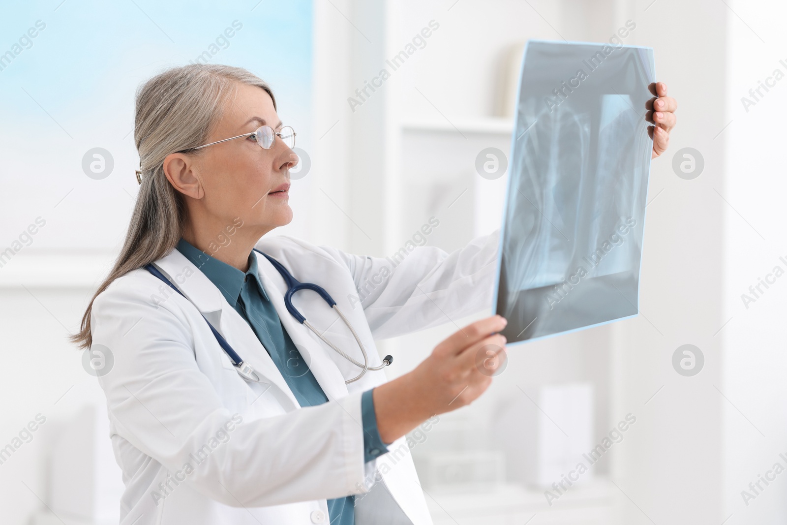 Photo of Lung disease. Doctor examining chest x-ray in clinic