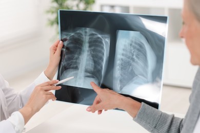 Photo of Lung disease. Doctor showing chest x-ray to her patient in clinic, closeup
