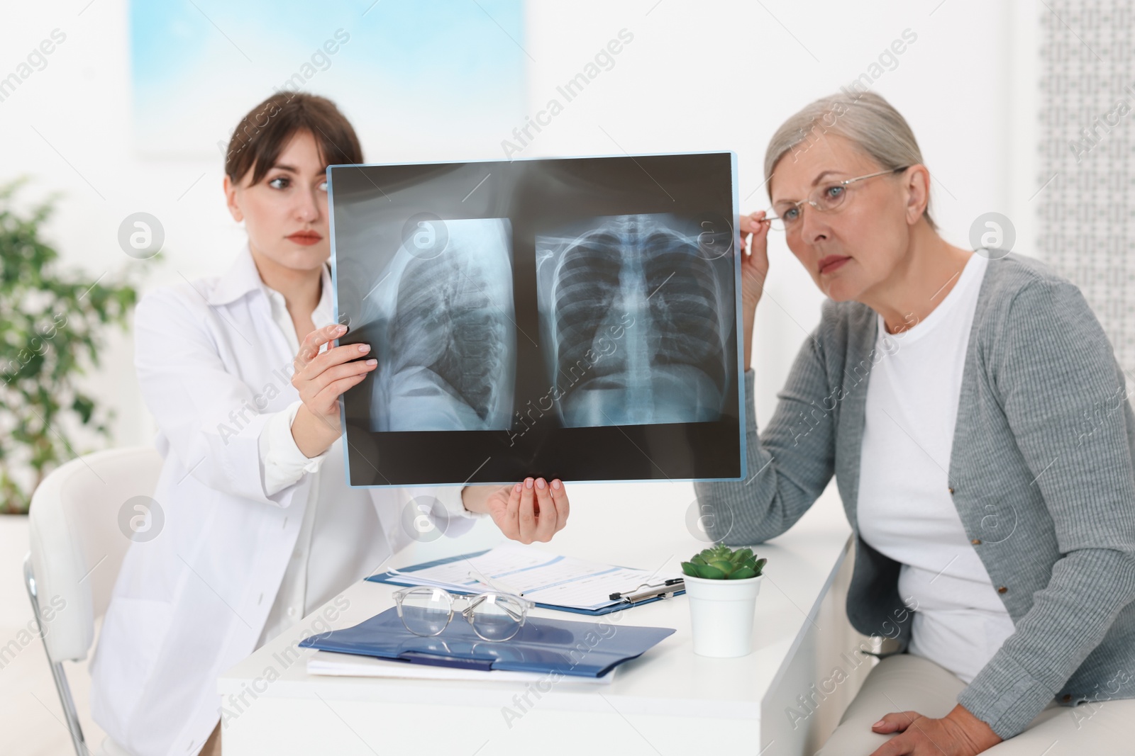 Photo of Lung disease. Doctor showing chest x-ray to her patient at table in clinic