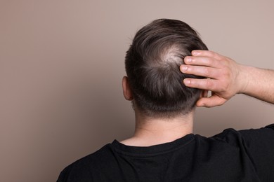 Baldness concept. Man with bald spot on beige background, back view