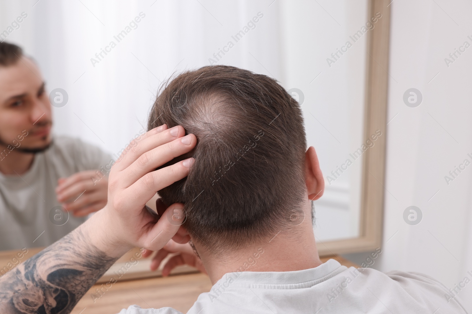 Photo of Baldness concept. Man with bald spot looking at mirror indoors, back view