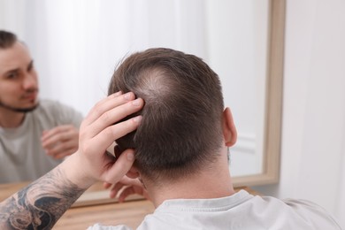 Photo of Baldness concept. Man with bald spot looking at mirror indoors, back view