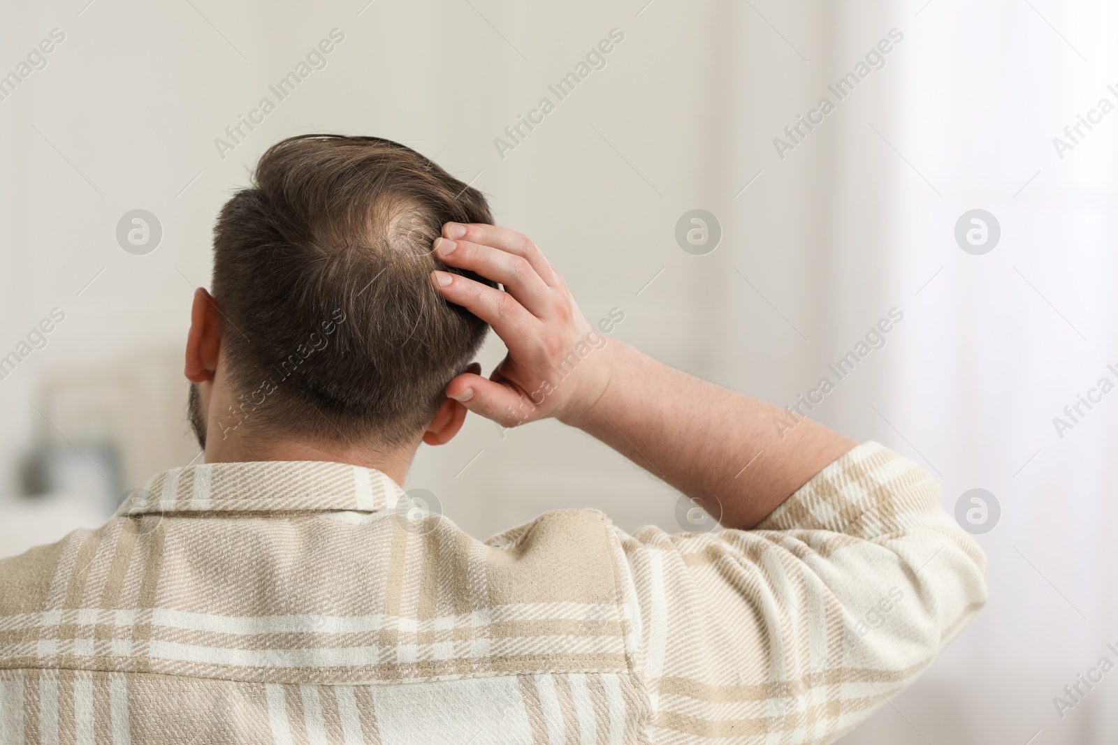 Photo of Baldness concept. Man with bald spot indoors, back view