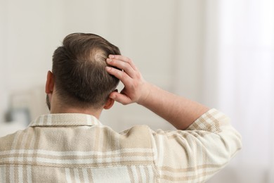 Baldness concept. Man with bald spot indoors, back view