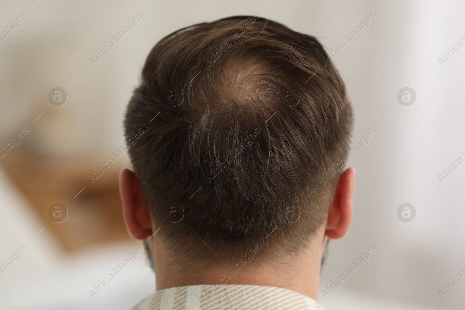 Photo of Baldness concept. Man with bald spot indoors, back view