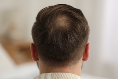 Photo of Baldness concept. Man with bald spot indoors, back view