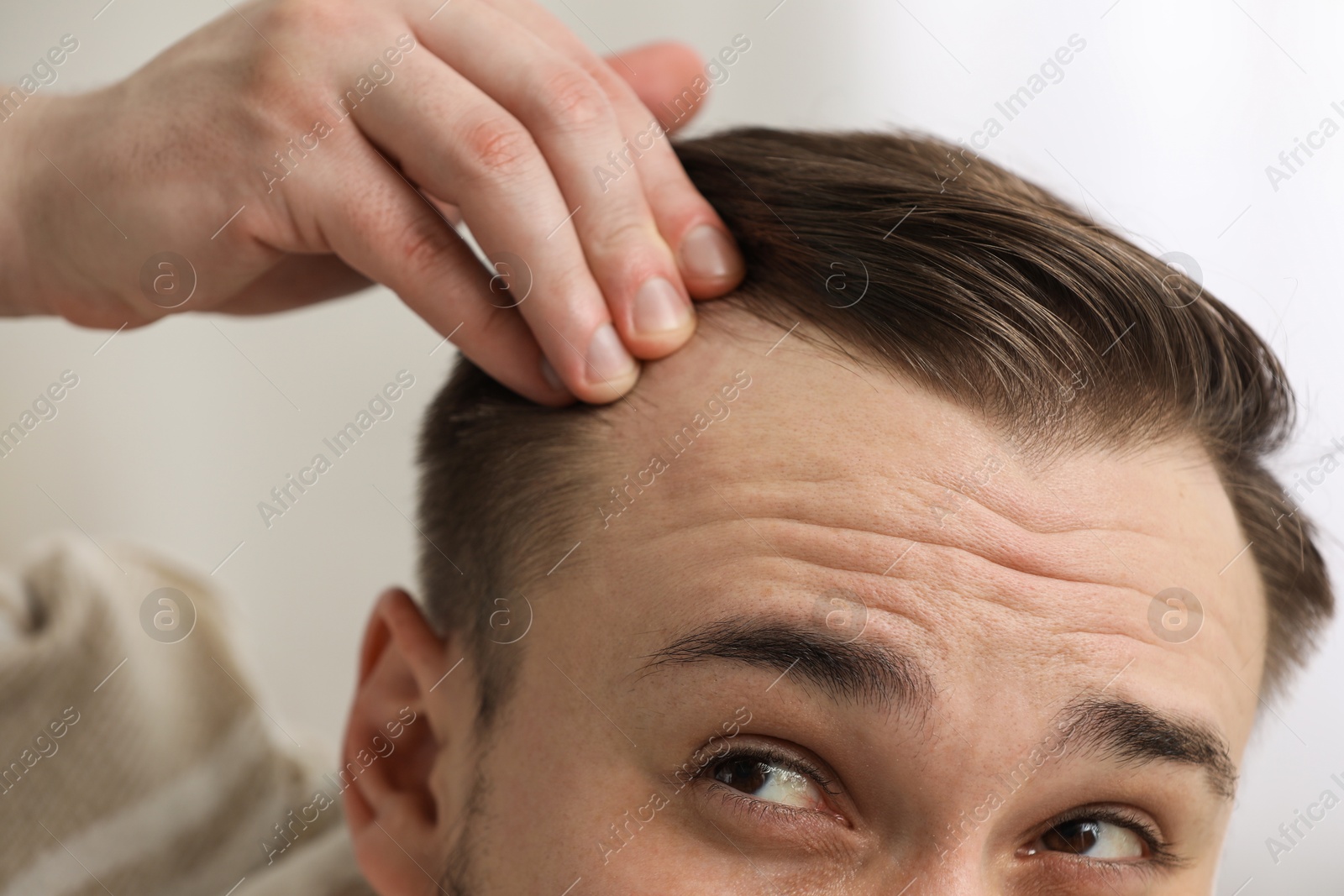 Photo of Baldness concept. Man with receding hairline indoors, closeup