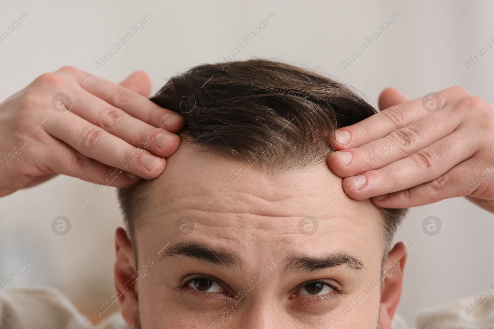 Photo of Baldness concept. Man with receding hairline indoors, closeup