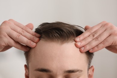 Photo of Baldness concept. Man with receding hairline indoors, closeup