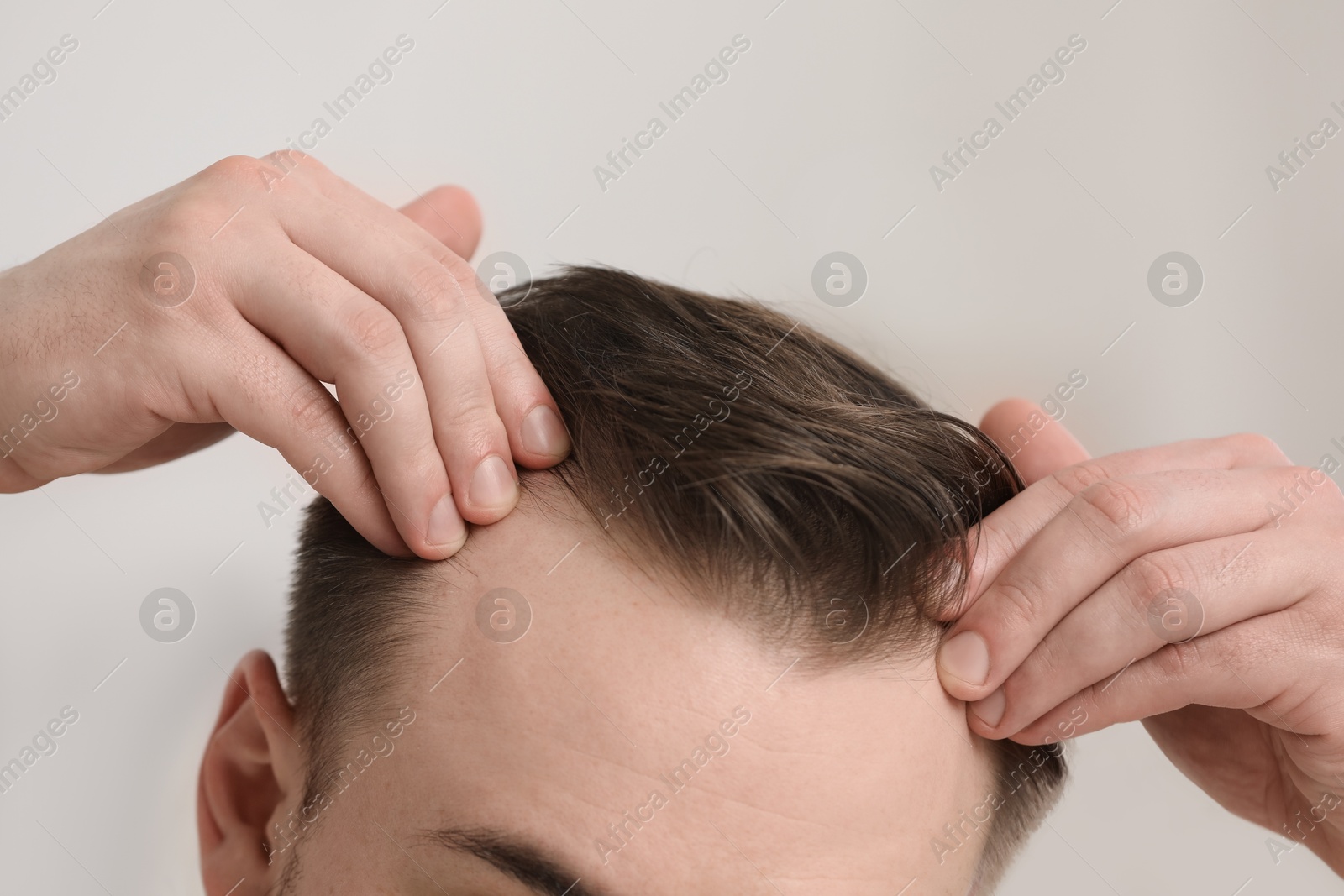 Photo of Baldness concept. Man with receding hairline indoors, closeup