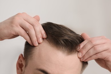 Photo of Baldness concept. Man with receding hairline indoors, closeup