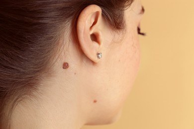 Woman with mole on her skin against beige background, closeup