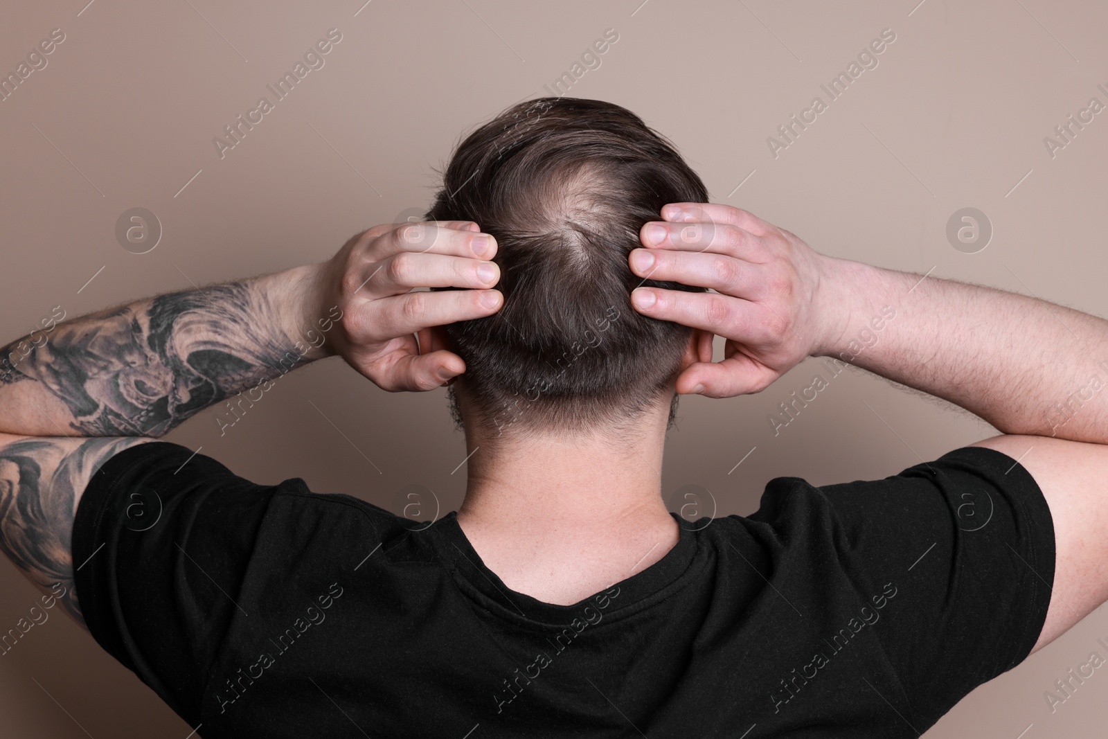 Photo of Baldness concept. Man with bald spot on beige background, back view