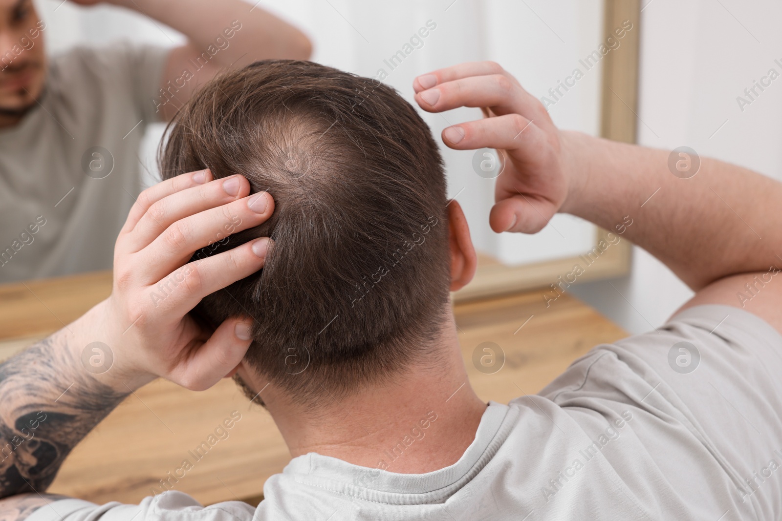 Photo of Baldness concept. Man with bald spot looking at mirror indoors, back view