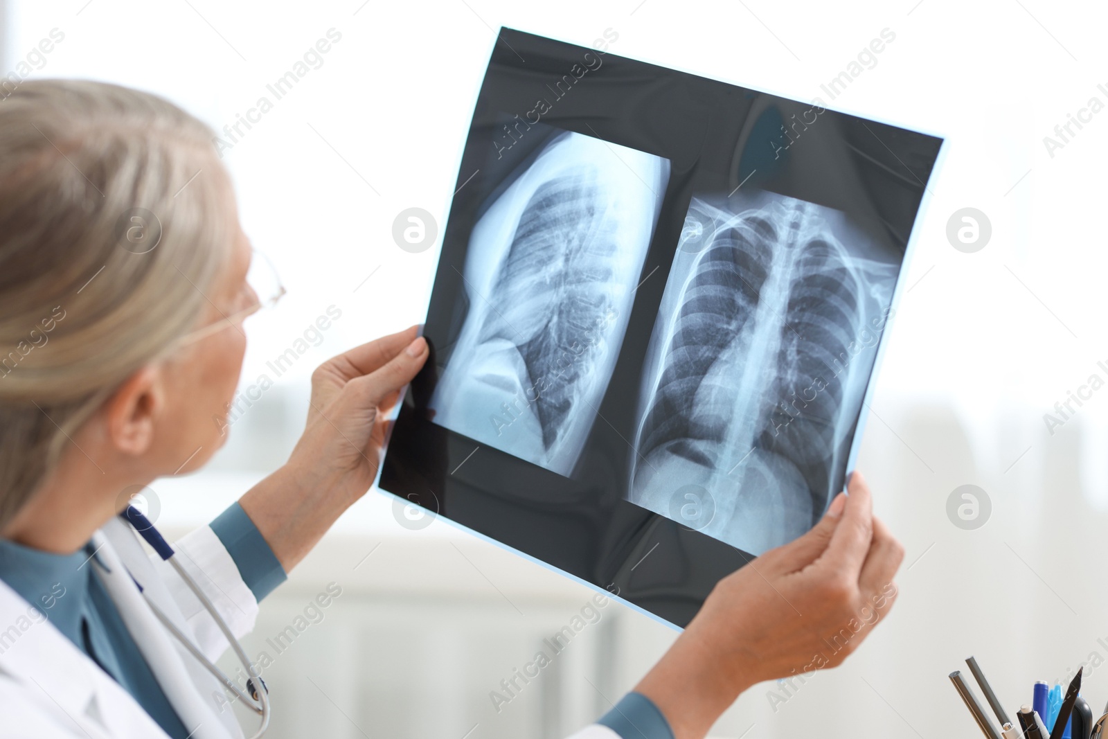 Photo of Lung disease. Doctor examining chest x-ray in clinic