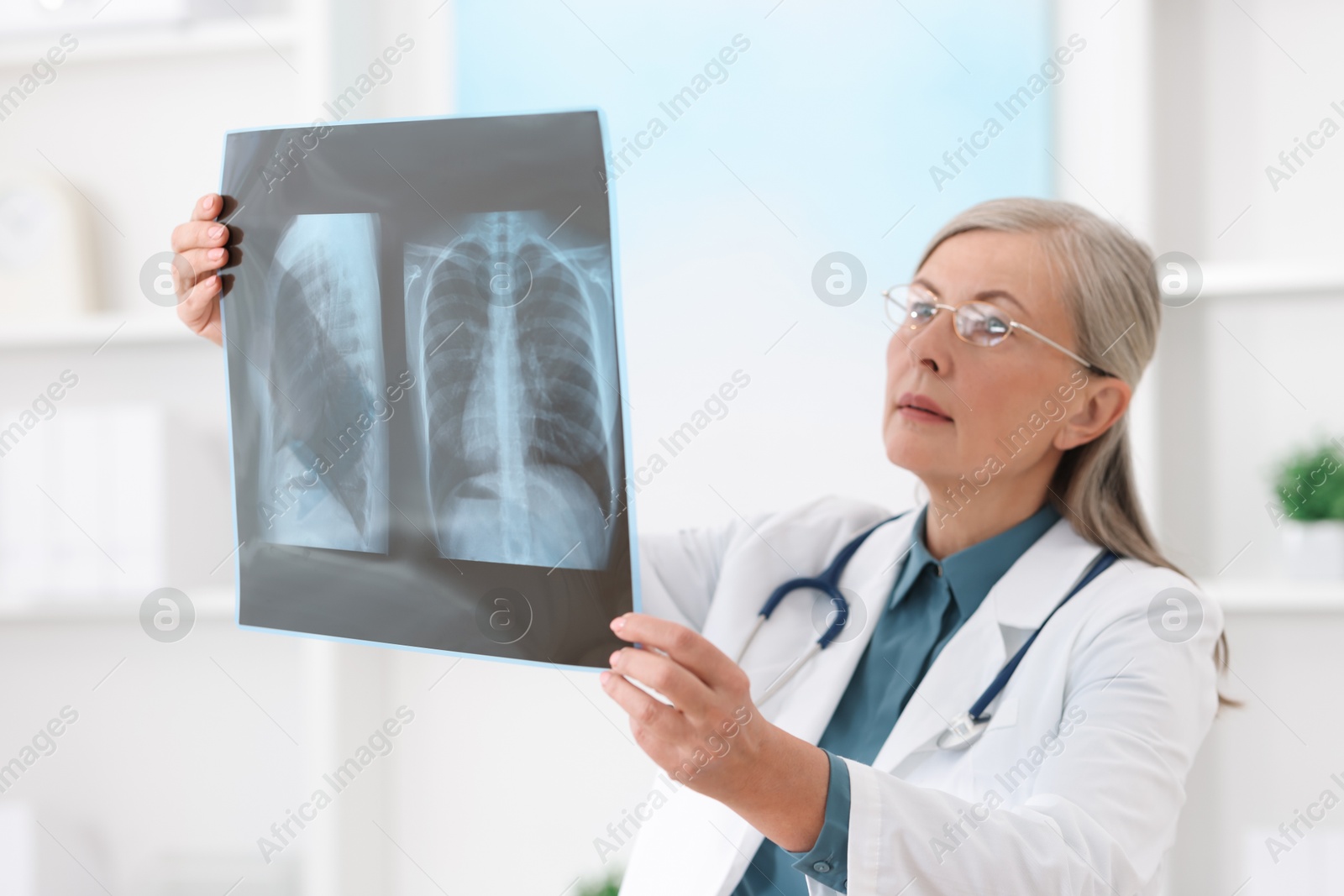 Photo of Lung disease. Doctor examining chest x-ray in clinic