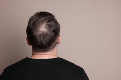 Baldness concept. Man with bald spot on beige background, back view. Space for text