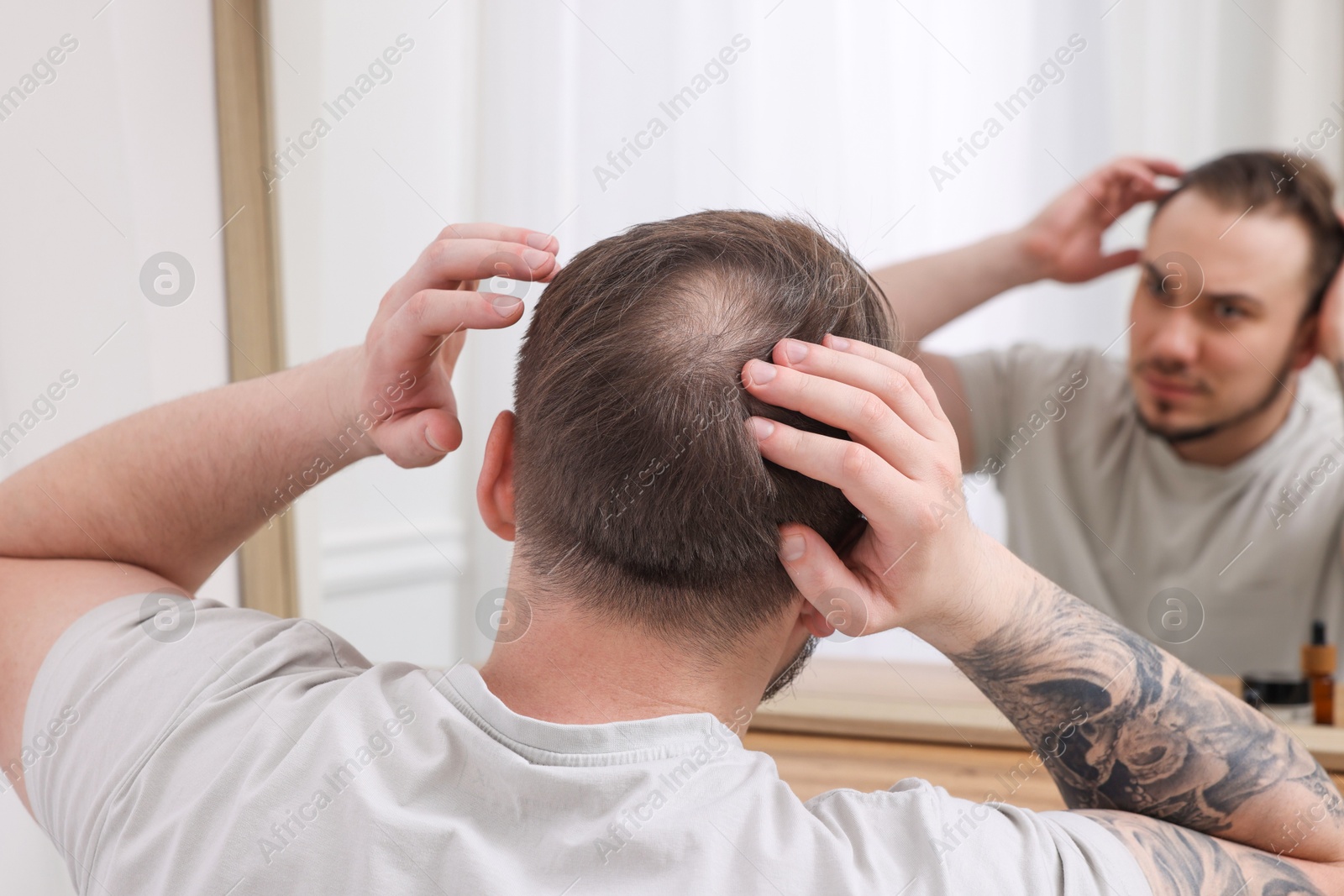 Photo of Baldness concept. Man with bald spot looking at mirror indoors, back view