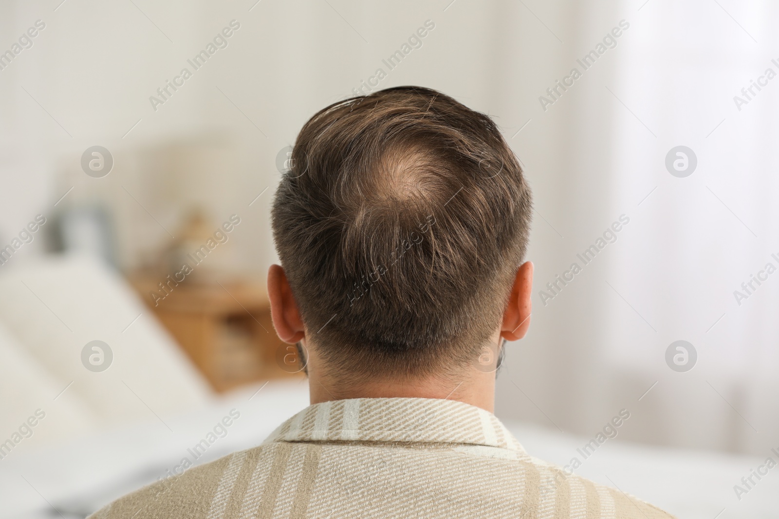 Photo of Baldness concept. Man with bald spot indoors, back view