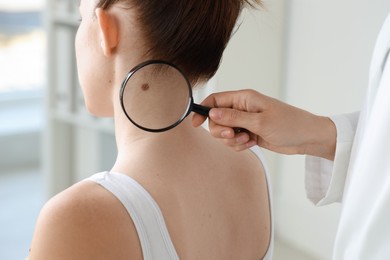 Doctor examining woman's mole with magnifying glass in clinic, closeup