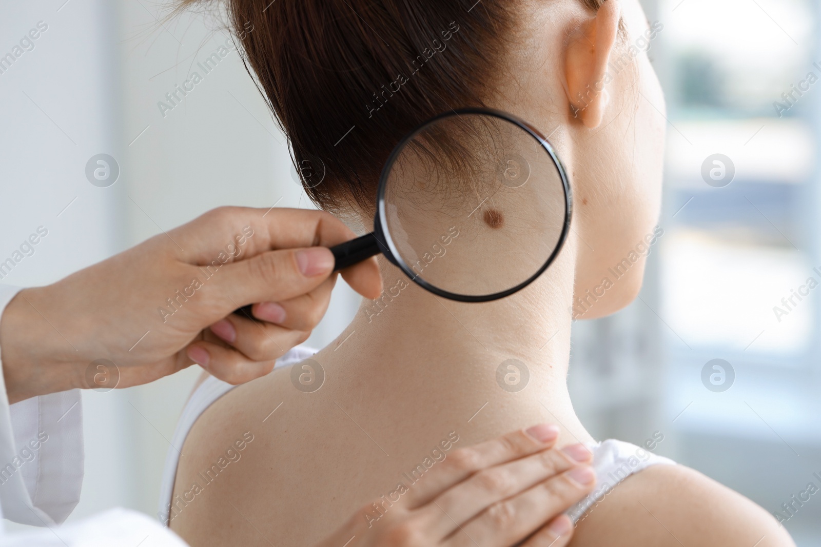 Photo of Doctor examining woman's mole with magnifying glass in clinic, closeup