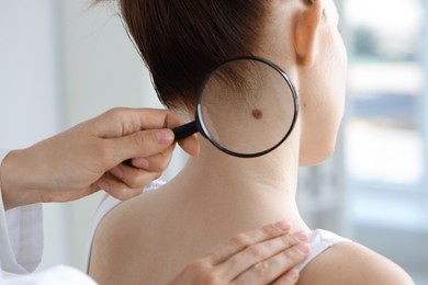 Doctor examining woman's mole with magnifying glass in clinic, closeup